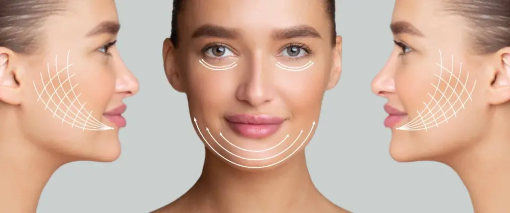 What you need to know about Euro Thread Lift