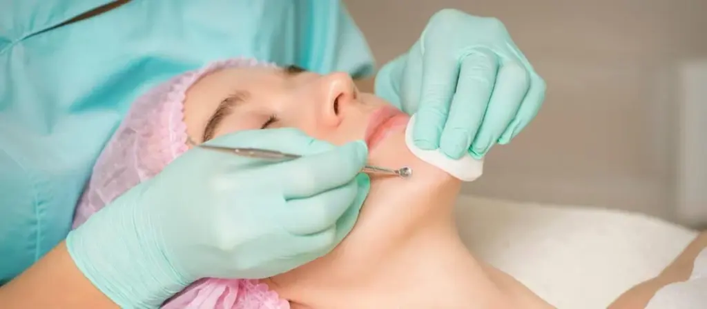 Can Chin Fat Be Removed