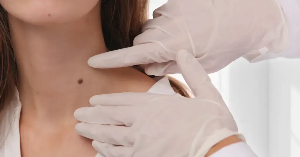 Dermatologist performing Lamprobe treatment in Yuma, AZ, to safely remove skin imperfections
